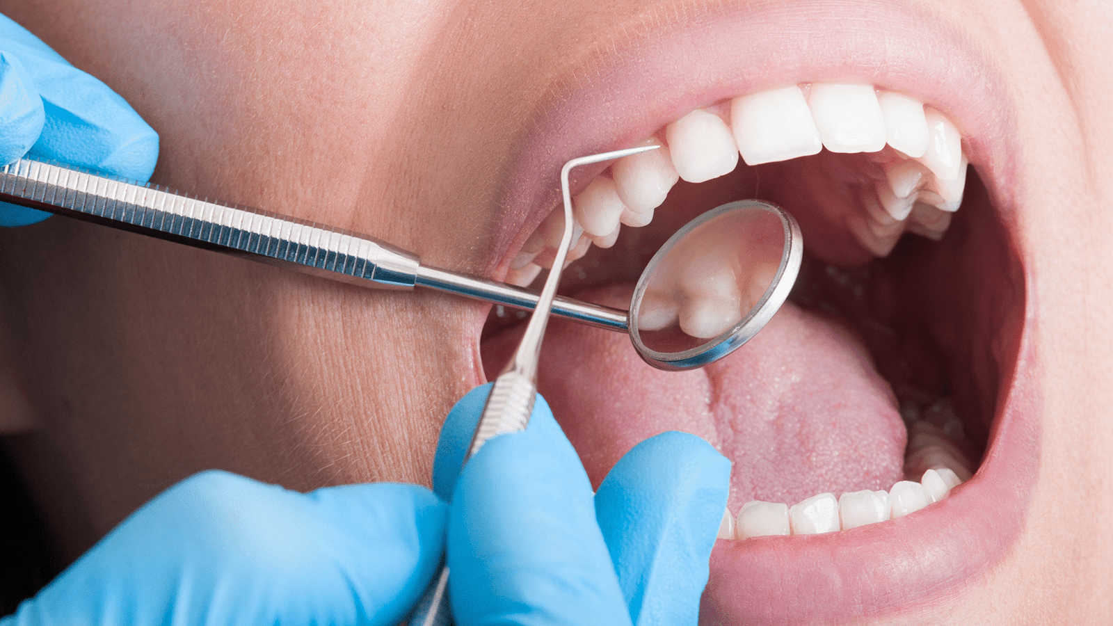 Patient receiving a dental examin Edinburg, McAllen, Pharr TX at Ethos Modern Dental