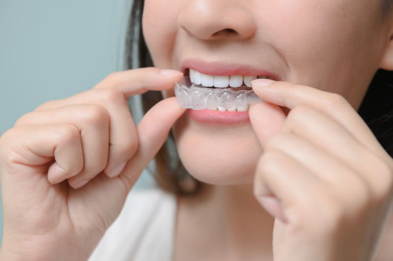 Patient wearing clear aligners at Ethos Modern Dental in Edinburg, McAllen, Pharr TX