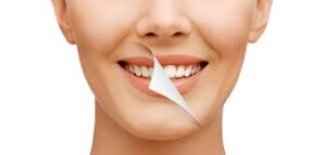 Bright smiles start with facts — learn what really works for teeth whitening.
