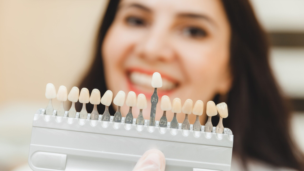 The Ultimate Guide to Crowns, Veneers & Bridges: Restore Your Smile With Confidence
