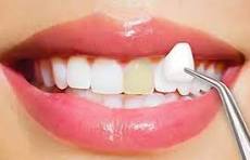 Smiling woman with bright white teeth promoting cosmetic dentistry at Ethos Modern Dental in Edinburg, McAllen, and Pharr, TX.