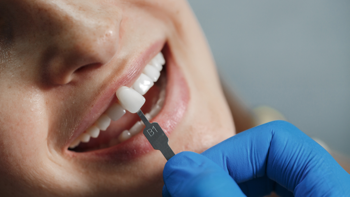 Dental Implants in Edinburg