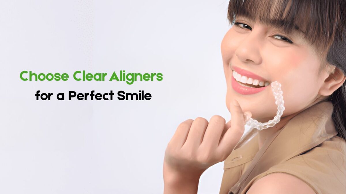 Clean aligner