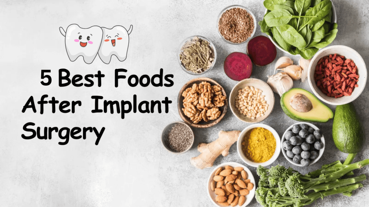 food to eat after dental implant